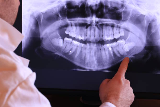 Best Emergency Dentist for Special Needs Patients in Merrifield, VA