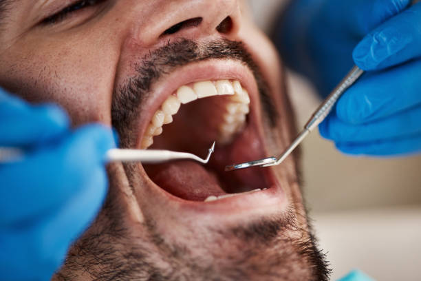 Best Emergency Dental Care for Abscessed Tooth in Merrifield, VA
